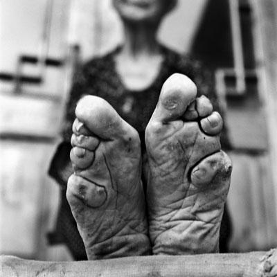 Bound feet, reportage photos sur ces chinoises aux pieds bandés